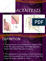 Thoracentesis