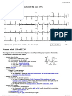 Normal Ecg - Ekg