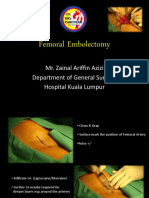 Femoral Embolectomy