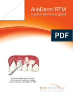 Alloderm Surgical Technique Guide PDF