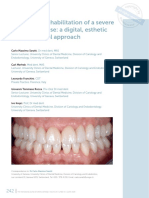 Full-Mouth Rehabilitation of A Severe Tooth Wear Case: A Digital, Esthetic and Functional Approach