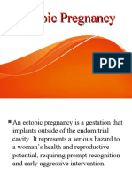 Ectopic Pregnancy22