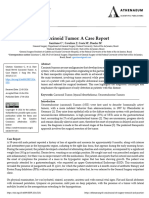 Rare Small Bowel Carcinoid Tumor A Case Report