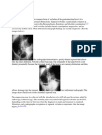 Volvulus Medscape