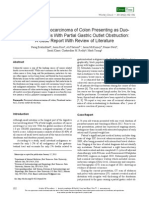 Recurrent Adenocarcinoma of Colon Presenting As Duo-Denal Metastasis With Partial Gastric Outlet Obstruction: A Case Report With Review of Literature