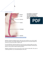 Dysphagia: by Mayo Clinic Staff