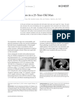 Mediastinal Mass in A 25-Year-Old Man: Chest Imaging and Pathology For Clinicians