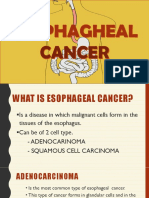 Esophageal CA