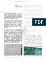 Management of A Case of Ventricular Bigeminy Using