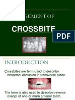 Cross Bite