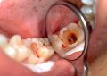 Счастливые клиенты, здоровые зубы: отзывы о семейной стоматологии 
