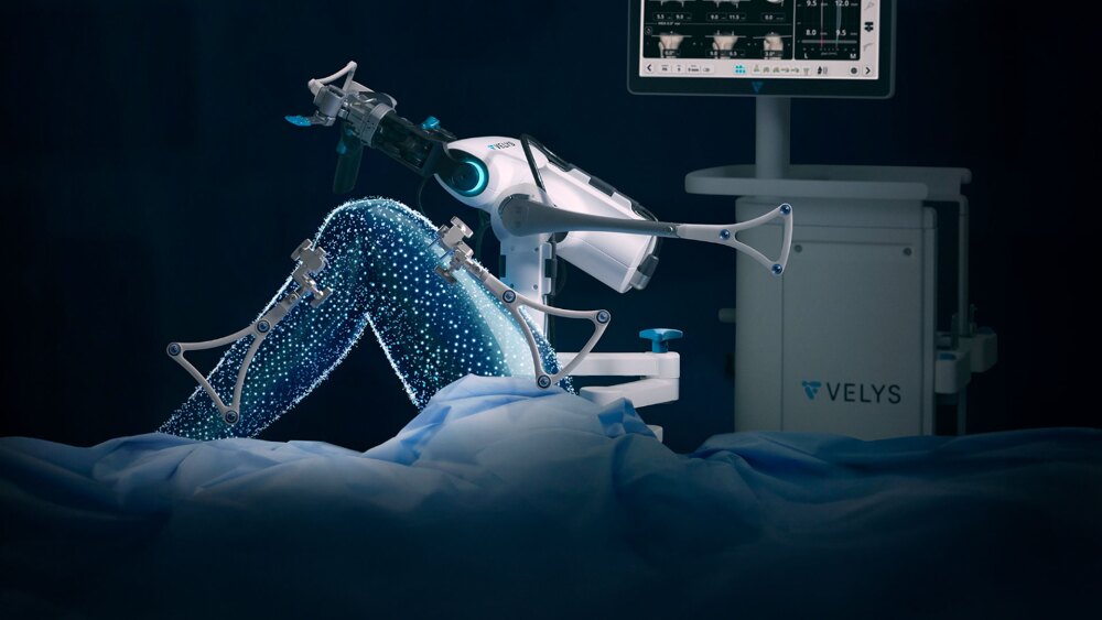 Johnson and Johnson's VELYS Robotic assisted solution for knee replacement surgery - innovative medical technology for orthopaedic surgery