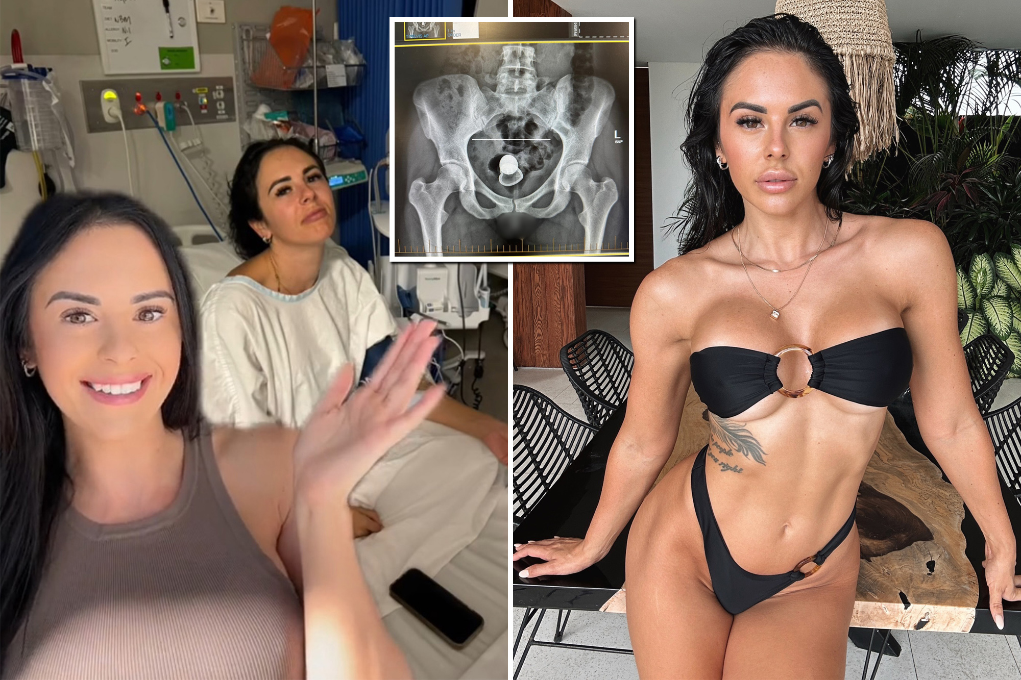 'Unfortunate sex mishap' on first date leaves porn star in the hospital for 2 days