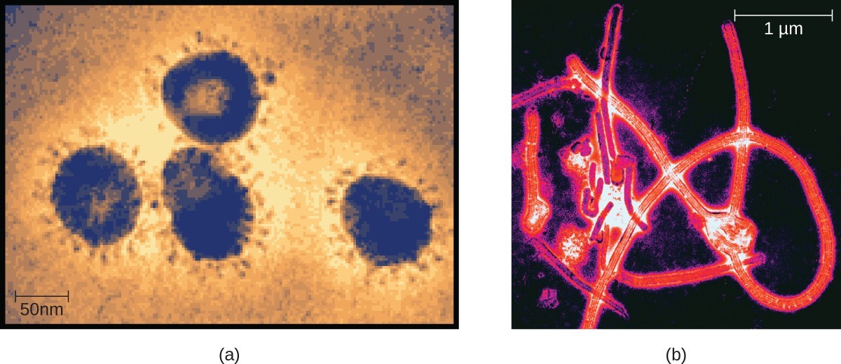 (a) Members of the Coronavirus family can cause respiratory infections like the common cold, severe acute respiratory syndrome (SARS), and Middle East respiratory syndrome (MERS). Here they are viewed under a transmission electron microscope (TEM). (b) Ebolavirus, a member of the Filovirus family, as visualized using a TEM.