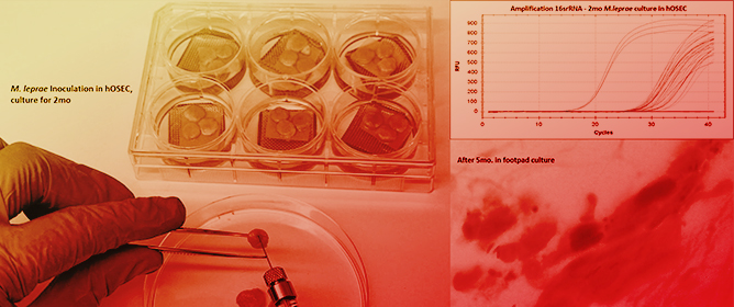 New Model for Studies of <em>M. leprae</em> and Leprosy