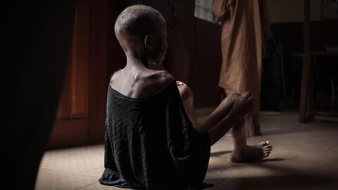 Un enfant victime de malnutrition au Centre pédiatrique de Bangui, le 4 décembre 2018. Plus de 43 000 enfants de moins de cinq ans devraient être confrontés à un risque extrêmement élevé de décès dû à la malnutrition en 2019, selon l'UNICEF.