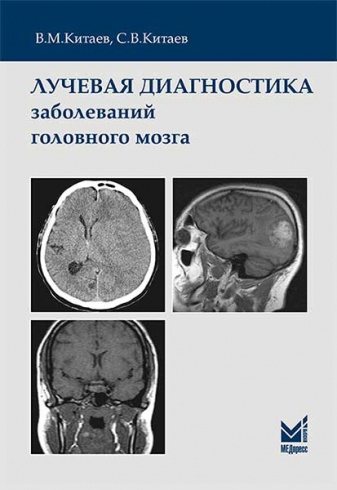 Лучевая диагностика заболеваний головного мозга