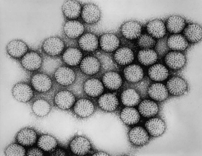 File:Rotavirus TEM B82-0337 lores.jpg