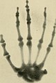 Röntgen ray diagnosis and therapy (1904)