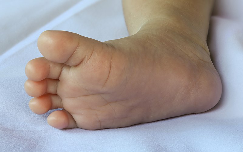 File:Sole of foot of a two week old Asian infant on a white bed sheet, focus stacking.jpg