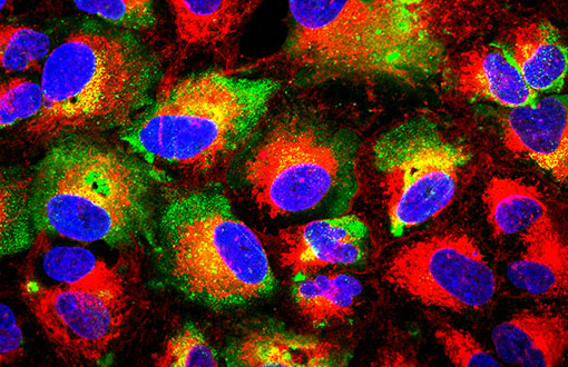 Nucleocapsid protein