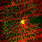 Eine Nervenzelle in der Netzhaut einer Maus, sichtbar gemacht mit dem Zwei-Photonen-Fluoreszenzmikroskop.