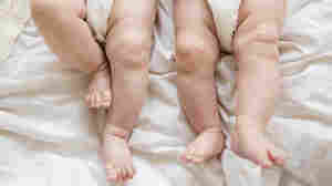 Twin Birthrate Drops For First Time Since The '80s