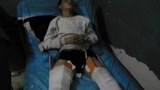 Tibetan teenager Dadul is shown in a hospital in Xining, Qinghai province, with broken legs following a beating by Chinese police.