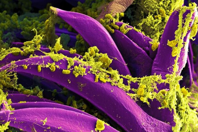 Электронная микрофотография бактерий Yersinia pestis