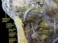 Maxillary artery