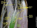 Vastus medialis muscle