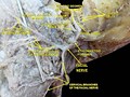 Lateral head anatomy detail. Facial nerve dissection.