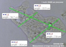 Measurements of a large amoeba at 400x.