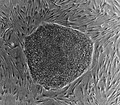 Human embryonic stem cell colony on mouse embryonic fibroblast feeder layer