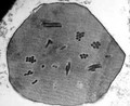 Baculovirus (Baculoviridae)