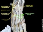 Extensor digitorum muscle