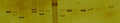 DNA samples amplified using PCR. Samples have been visualized using silver staining.