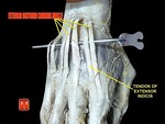 Extensor digitorum muscles