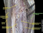 Extensor digitorum muscle