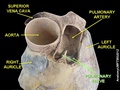 Pulmonary valves