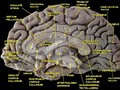 Медиальная поверхность полушария головного мозга