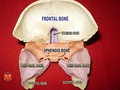 Sphenoid bone and temporal bones
