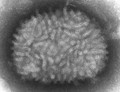 Virus vacuna (Poxviridae)