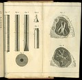 De l'auscultation médiate .... Drawings of the stethoscope and lungs.