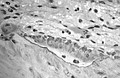 Osteoblasts actively synthesizing osteoid containing two osteocytes.