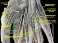 Adductor pollicis muscle