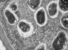 Срез через клубенёк сои (Glycine max). На снимке видна клетка растения с бактероидом Bradyrhizobium japonicum внутри.