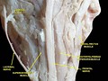 Extrinsic eye muscle. Nerves of orbita. Deep dissection.