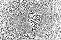 Light micrograph of undecalcified tissue displaying osteoblasts actively synthesizing rudimentary bone tissue (center).