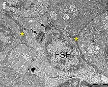 An image of the Gonadotropic cell